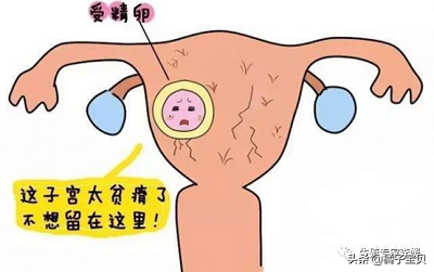 北京试管助孕:你的子宫内膜适合移植吗?