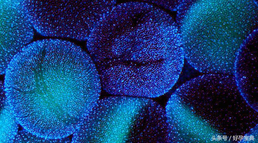 50万包性别-试管婴儿是不是一定要做促排卵？