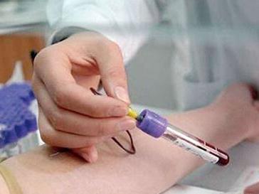 生儿子-血hcg检查怎么做？有什么作用呢？