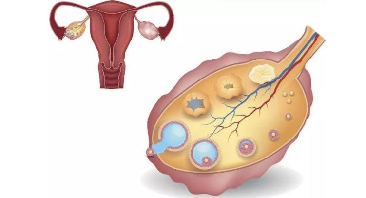 临床招募：南京鼓楼医院干细胞治疗卵巢早衰患者招募
