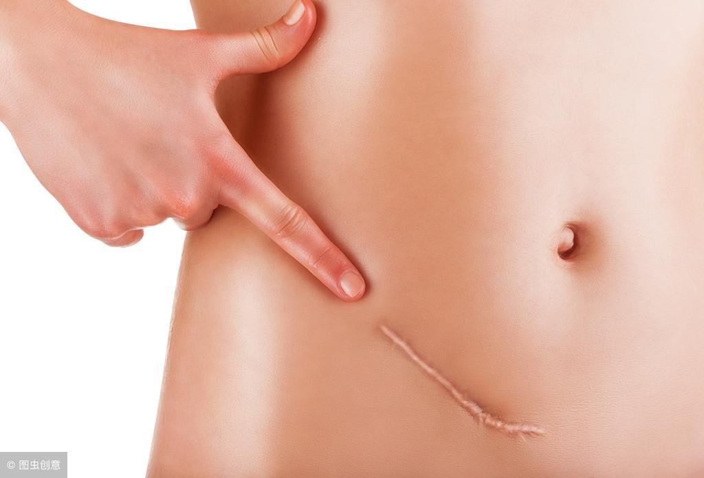 代孕公司怎么选,子宫内膜息肉是什么呢?子宫息肉形成的原因是什么