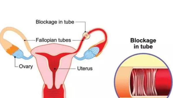 子宫环境对于试管胚胎着床率的影响有多大？