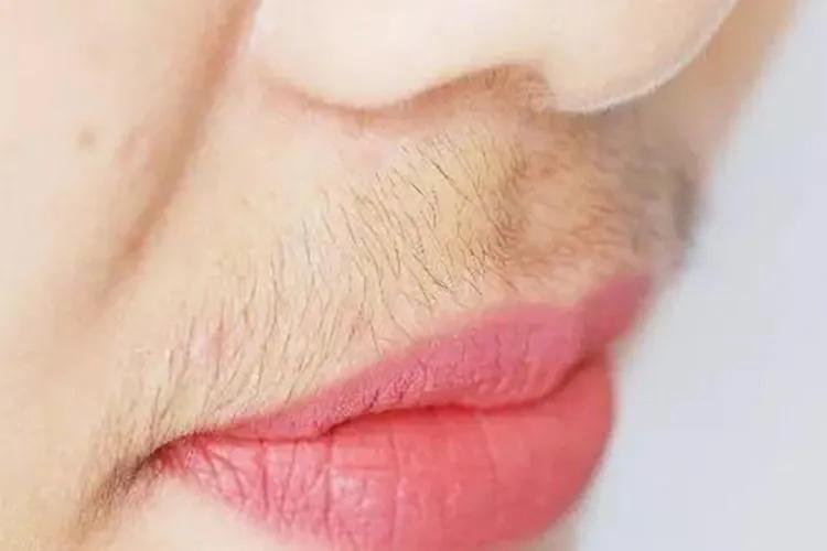 多囊卵巢是什么样的症状~供卵机构电话