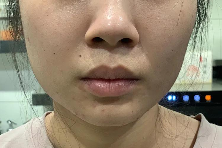 多囊卵巢是什么样的症状~供卵机构电话