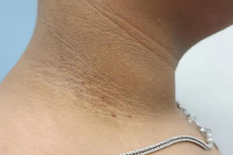 多囊卵巢是什么样的症状~供卵机构电话