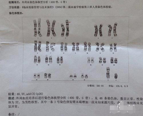 做试管婴儿要具备的4项条件,哪里招试管代孕