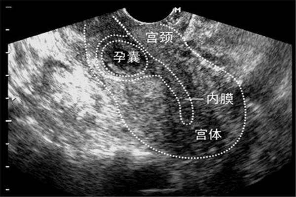 多次试管婴儿失败怎么办?哪些因素导致了反复失败?