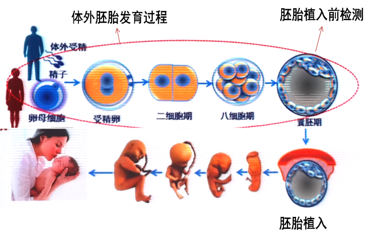 助孕机构-胚胎植入前遗传学诊断技术专题