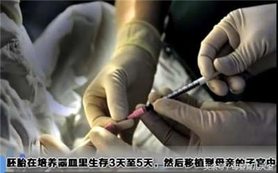 试管婴儿服务-揭秘“试管婴儿”诞生全过程!