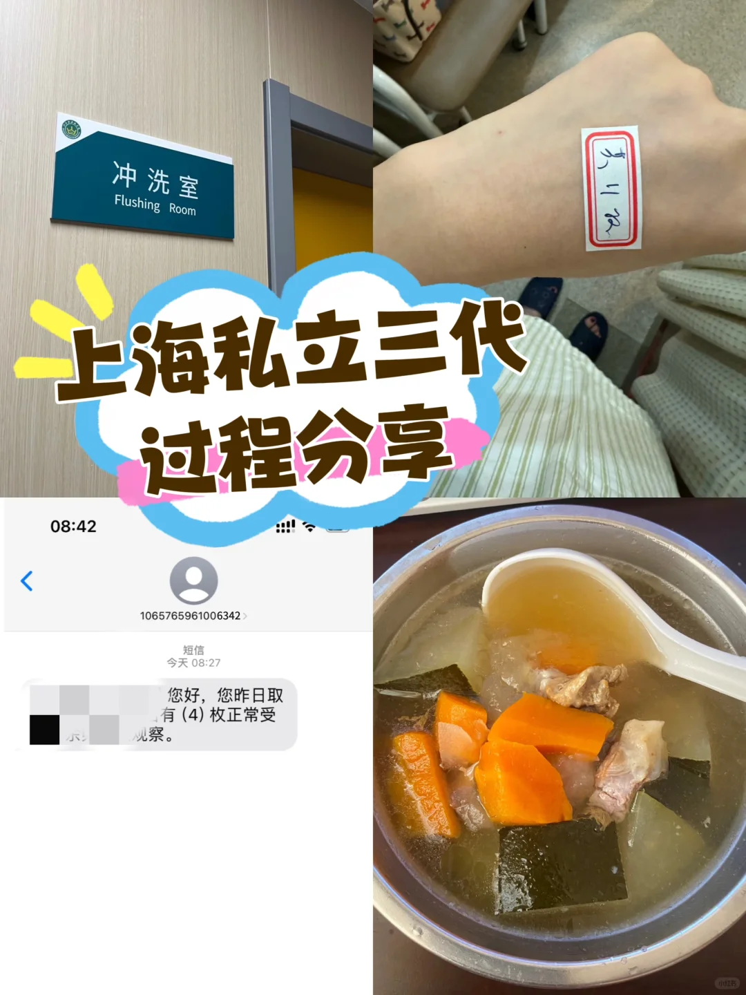 上海私立三代全麻取l过程分享