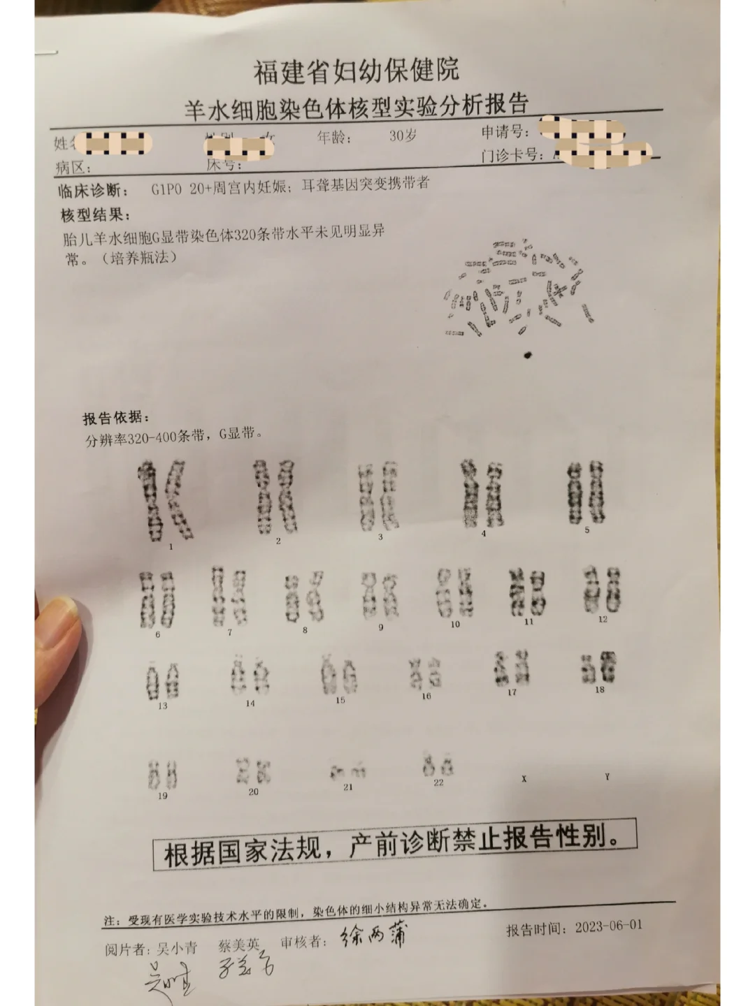 羊水穿刺结果要等多久？