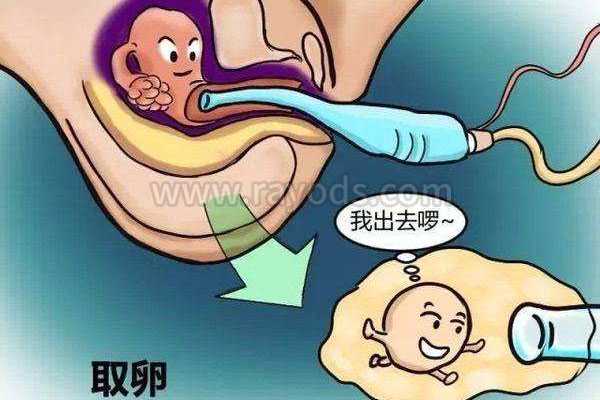 凉城县有做过代孕的吗_凉城县找代孕女多少钱_美国试管婴儿注射“破卵针”的