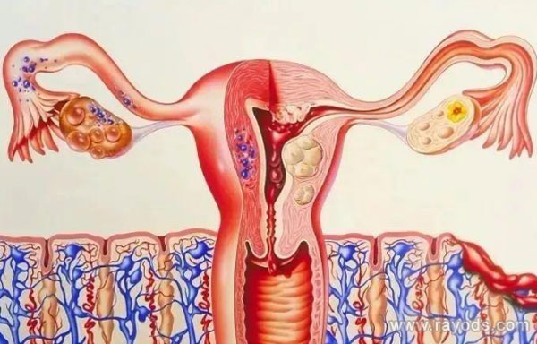 子宫内膜不典型增生可以做泰国试管婴儿吗,成功率高吗?,借卵代怀价格