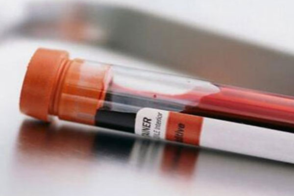 唐氏筛查结果判断 唐氏筛查afp是什么意思~做试管医院