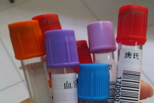 唐氏筛查结果判断 唐氏筛查afp是什么意思~做试管医院