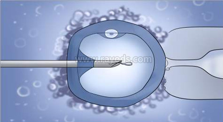 代生咨询~必看！国内、美国、泰国试管婴儿医院排行榜！